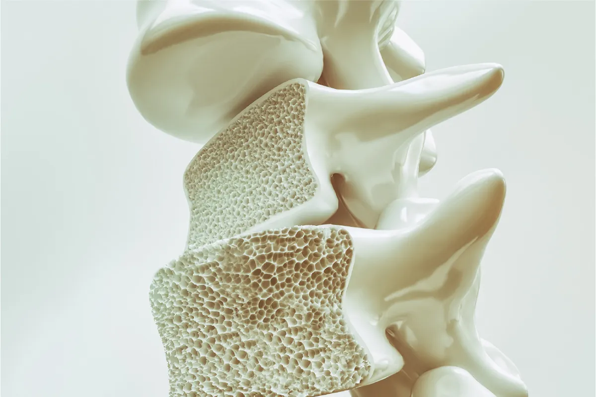 骨粗しょう症の検査と治療