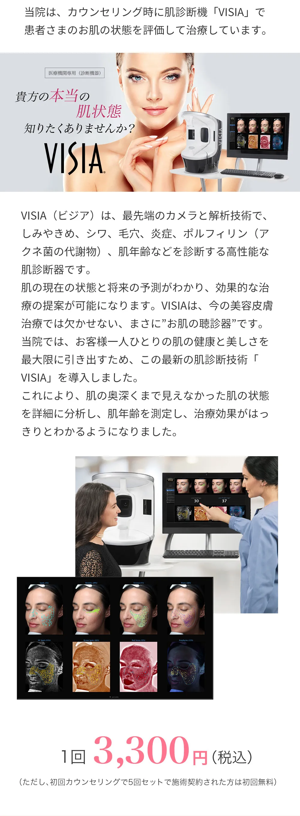 肌診断機 VISIA