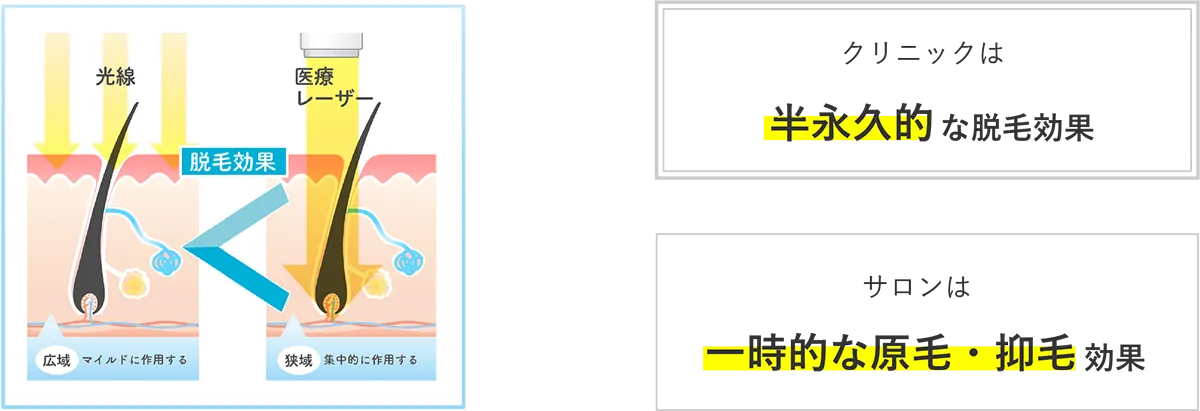 クリニックは半永久的な脱毛効果、サロンは一時的な原毛、抑毛効果